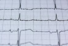 neural technology advancement unveiled